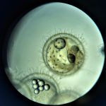 メダカの卵観察